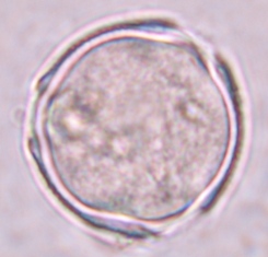 Lyc ten 3